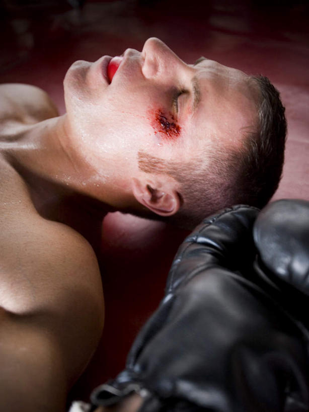 西方人,脸,头,脸颊,一个人,拳击手,体育馆,运动场,躺,闭眼,竖图,俯视,室内,特写,白天,锻炼,安全,比赛,运动,拳击,欧洲,欧洲人,仅一个男性,仅一个人,防护,拳击手套,地面,运动器械,体育场,裸露,肩膀,仅一个年轻男性,两个,红色,黑色,手套,健身器械,血液,保护,裸,保险,受伤,健身器材,保全,周全,安稳,安定,运动馆,防护手套,卧着,平安,体育,男人,男性,年轻男性,白种人,头部,脸部,脸蛋,面部,拳击家,拳击运动员,闭眼睛,闭着眼,闭着眼睛,躺着,卧,半身,彩图,高角度拍摄,健身,运动器材,淤青