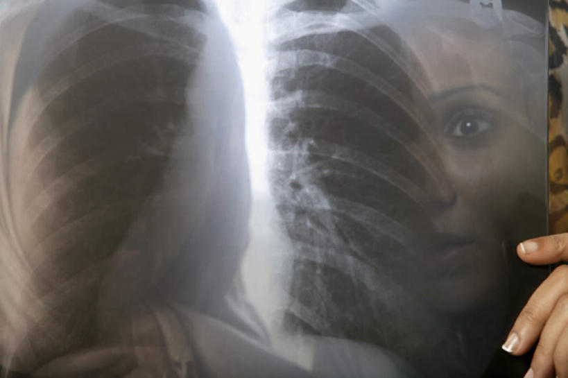 脸,头,脸颊,两个人,伙伴,朋友,站,横图,x光片,室内,特写,白天,正面,友谊,亚洲,握,朦胧,模糊,辐射,科学,医学,拿,拿着,注视,观察,看,站着,握着,遮,遮掩,观看,察看,医疗,科学技术,x射线,掩盖,遮挡,关注,x光,遮盖,掩饰,友情,年轻女性,女人,女性,阿拉伯人,白种人,亚洲人,头部,脸部,脸蛋,面部,站立,半身,彩图,电磁波,电磁辐射