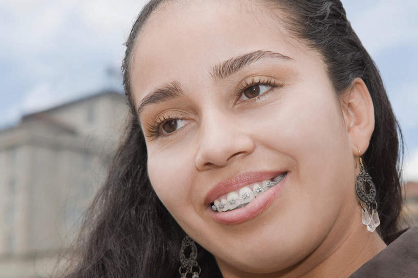 西方人,脸,头,脸颊,脖子,头发,一个人,笑,微笑,露齿笑,横图,室外,特写,白天,正面,欧洲,欧洲人,仅一个年轻女性,仅一个女性,仅一个人,阴影,朦胧,模糊,光线,影子,云,云朵,云彩,注视,装饰品,蓝色,黑色,白云,蓝天,天空,阳光,耳环,模型,饰品,首饰,天,观察,看,晴朗,模具,观看,察看,关注,矫正,牙科,牙套,牙箍,校正,校准,牙饰,耳饰,年轻女性,女人,女性,白种人,头部,长发,直发,脖,颈,颈部,脸部,脸蛋,面部,晴空,半身,彩图