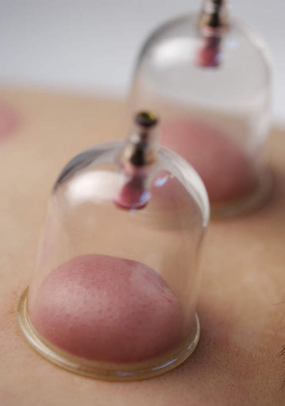 东方人,一个人,竖图,俯视,室内,特写,白天,白色背景,亚洲,仅一个男性,仅一个人,朦胧,模糊,医学,罐子,黄种人,文化,玻璃制品,仅一个年轻男性,两个,玻璃瓶,瓶子,趴着,治疗,保健,摄影,影棚,后背,医疗,中国文化,拔火罐,中医,火罐,医治,拔罐,拔罐疗法,拔罐子,火罐疗法,中医学,男人,男性,年轻男性,亚洲人,趴,半身,彩图,高角度拍摄,影棚拍摄,拍摄,传统文化