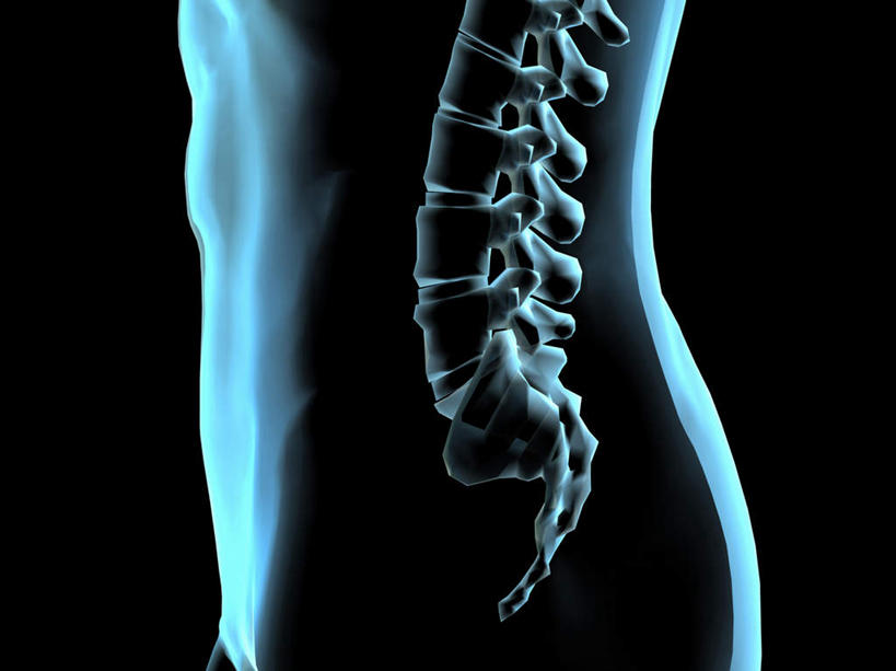 西方人,脊髓,骨盆,一个人,无人,横图,插画,x光片,室内,特写,白天,正面,数码,科技,欧洲,欧洲人,仅一个男性,仅一个人,阴影,黑色背景,辐射,科学,网络,医学,高光,几何,计算机图形,合成,图画,画,仅一个年轻男性,电脑合成图,数码合成图,医疗,科学技术,x射线,合成图,x光,漫画,写实,具体,具象,骶骨,髋骨,尾骨,胯骨,男人,男性,年轻男性,白种人,脊柱,半身,彩图,电磁波,电磁辐射