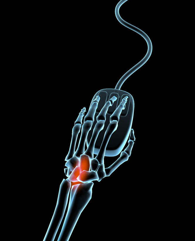 手,骨骼,无人,竖图,插画,x光片,室内,特写,白天,正面,鼠标,数码,科技,阴影,黑色背景,辐射,科学,网络,医学,骨头,高光,几何,计算机图形,合成,图画,输入设备,画,手部,单手,电脑合成图,数码合成图,骨架,医疗,科学技术,x射线,合成图,x光,漫画,写实,具体,具象,尺骨,肱骨,桡骨,腕骨,掌骨,指骨,彩图,电磁波,电磁辐射