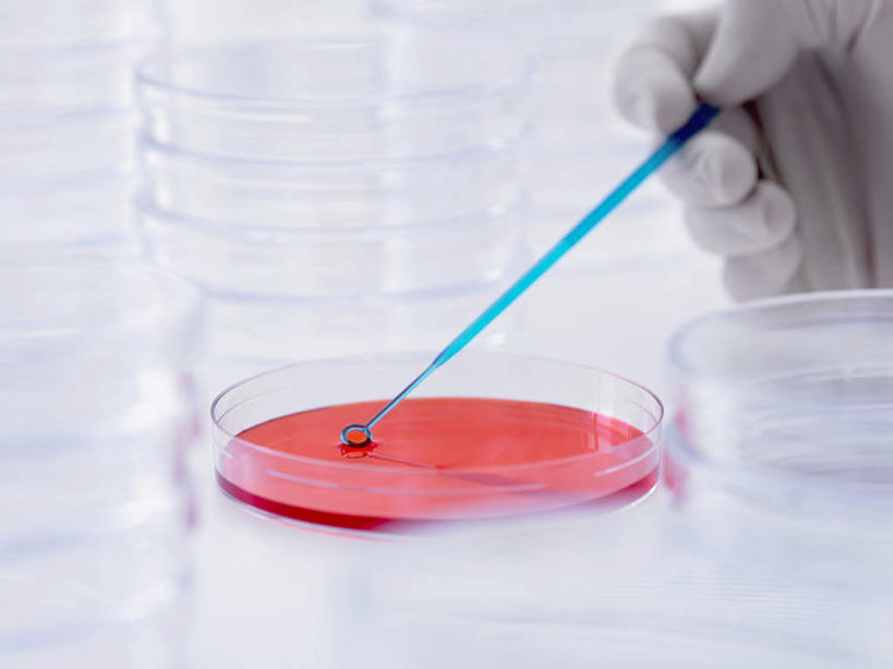 西方人,手,一个人,科学家,横图,俯视,室内,特写,白天,实验,仪器,欧洲,欧洲人,仅一个年轻女性,仅一个女性,仅一个人,一排,许多,握,阴影,研究,整齐,反射,分析,化学,测试,滴管,培养皿,影子,排列,手部,器皿,生物,握着,单手,科研人员,队列,研究者,皮氏培养皿,科学研究者,试验耗材,实验用品,化学器材,年轻女性,女人,女性,白种人,科学工作者,半身,彩图,高角度拍摄