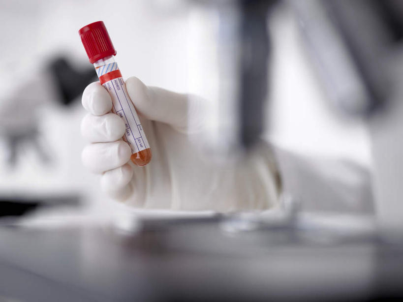 西方人,手,一个人,科学家,横图,室内,特写,白天,正面,安全,实验,研发,仪器,杯子,欧洲,欧洲人,仅一个年轻女性,仅一个女性,仅一个人,握,朦胧,模糊,研究,透明,分析,科学,化学,测试,试管,实验室,研究室,防护,拿,拿着,玻璃制品,玻璃瓶,瓶子,手套,手部,器皿,握着,保护,单手,科研,科研人员,化验,保险,研究者,检验,计量,研究所,科学研究者,玻璃仪器,试验耗材,实验用品,化验室,检验室,保全,周全,安稳,安定,防护手套,平安,年轻女性,女人,女性,白种人,科学工作者,玻璃杯,半身,彩图