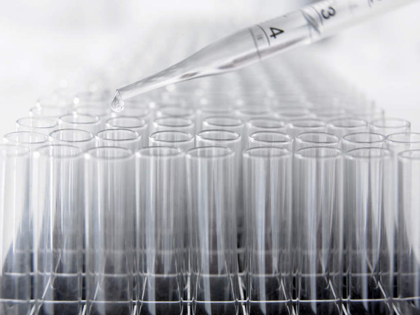 无人,横图,俯视,室内,特写,白天,实验,研发,仪器,水,静物,杯子,一排,许多,朦胧,模糊,研究,整齐,并列,并排,透明,分析,科学,化学,测试,滴管,试管,液体,实验室,水滴,研究室,很多,玻璃制品,排列,玻璃瓶,瓶子,器皿,科研,队列,化验,检验,平行,计量,研究所,玻璃仪器,试验耗材,实验用品,吸液管,化验室,检验室,移液管,玻璃杯,彩图,高角度拍摄