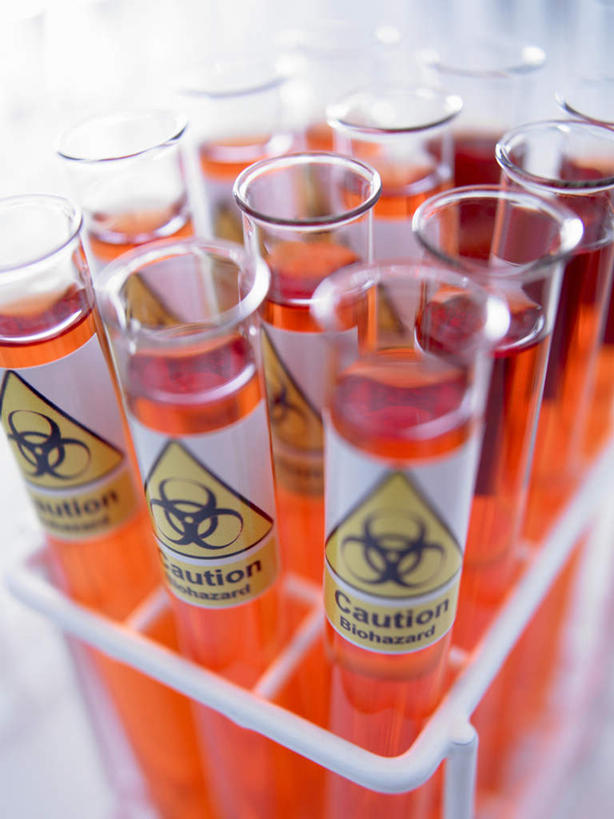 无人,竖图,俯视,室内,特写,白天,实验,研发,仪器,水,静物,杯子,一排,许多,朦胧,模糊,研究,整齐,并列,并排,透明,分析,科学,化学,测试,英文,标志,试管,文字,液体,字符,字母,实验室,水滴,研究室,很多,警告,标识,玻璃制品,排列,红色,玻璃瓶,瓶子,器皿,警示,英文字母,禁止,科研,提醒,队列,提示,限制,化验,检验,平行,计量,研究所,玻璃仪器,试验耗材,实验用品,化验室,检验室,危险,玻璃杯,彩图,高角度拍摄