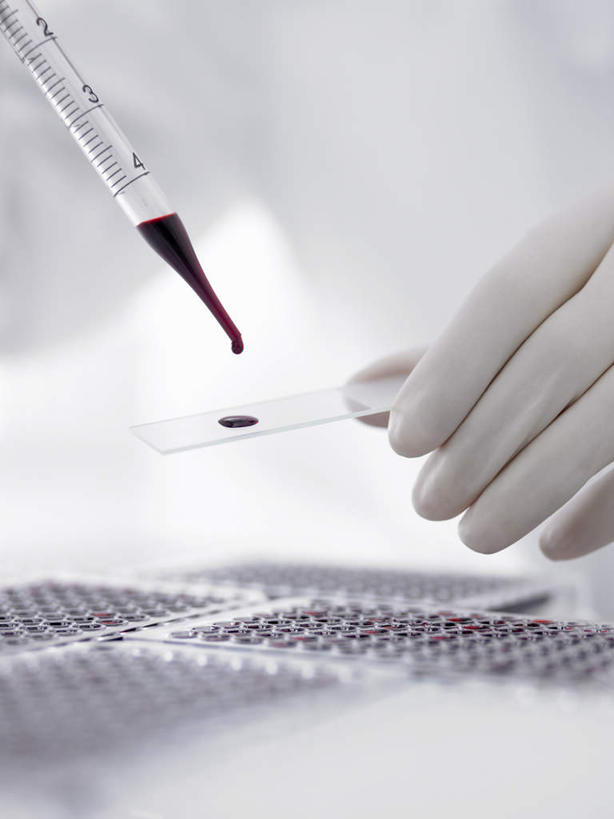 西方人,手,一个人,科学家,竖图,室内,特写,白天,正面,安全,实验,研发,仪器,欧洲,欧洲人,仅一个男性,仅一个人,仅一个中年男性,握,朦胧,模糊,研究,透明,分析,科学,化学,测试,滴管,液体,实验室,研究室,防护,拿,拿着,玻璃制品,手套,手部,器皿,握着,保护,单手,科研,科研人员,化验,保险,研究者,检验,计量,研究所,载玻片,科学研究者,玻璃仪器,试验耗材,实验用品,化验室,检验室,保全,周全,安稳,安定,防护手套,玻片,盖玻片,平安,男人,男性,中年男性,白种人,科学工作者,半身,彩图