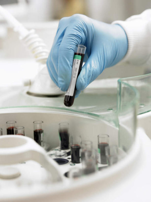 西方人,手,一个人,科学家,竖图,俯视,室内,特写,白天,工作服,制服,实验,仪器,杯子,欧洲,欧洲人,仅一个男性,仅一个人,仅一个中年男性,握,阴影,朦胧,模糊,研究,透明,反射,分析,化学,测试,试管,影子,拿,拿着,玻璃制品,玻璃瓶,瓶子,手套,手部,橡胶,器皿,握着,单手,科研人员,研究者,橡胶手套,计量,橡胶制品,科学研究者,玻璃仪器,试验耗材,实验用品,医用手套,工作制服,男人,男性,中年男性,白种人,科学工作者,玻璃杯,半身,彩图,高角度拍摄,工作套服