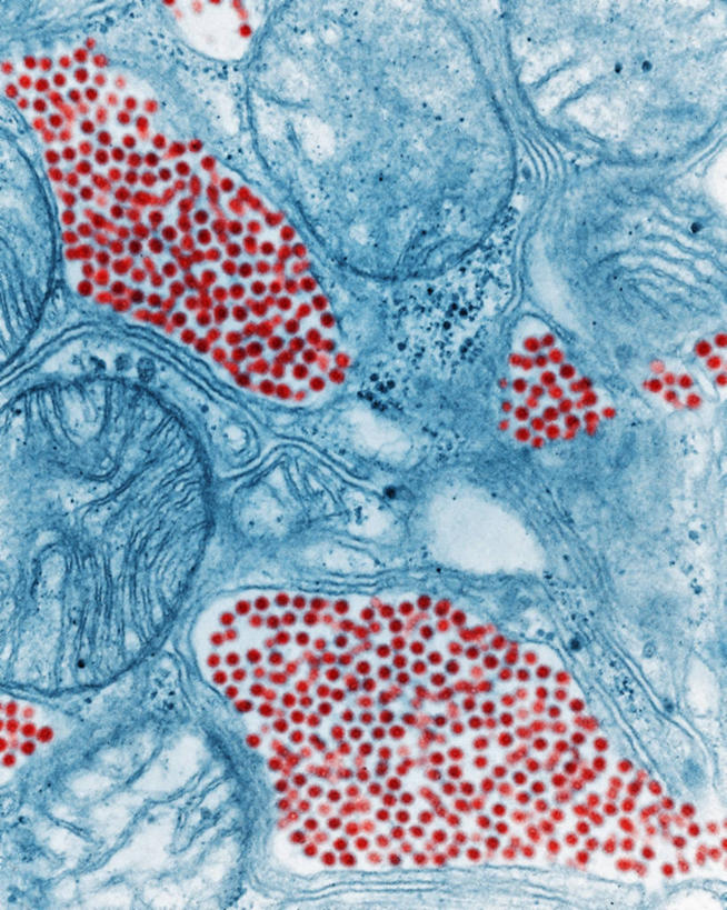 无人,竖图,蚊子,科学,生病,摄影,唾液腺,脑炎,彩图,电子显微镜