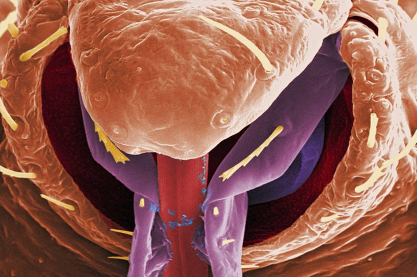 无人,横图,科学,红色,紫色,生病,橙色,摄影,生物学,害虫,臭虫,彩图,电子显微镜