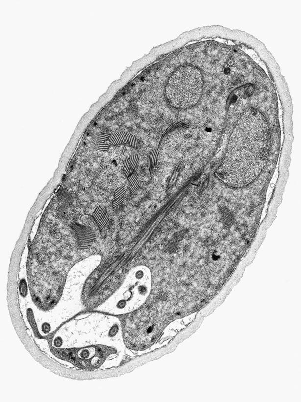 无人,竖图,黑白,科学,无脊椎动物,动物,生病,摄影,寄生虫,贾第虫,贾第虫病,原生动物,囊肿,电子显微镜,蓝伯贾第虫,蓝氏贾第鞭毛虫,蓝氏贾第虫