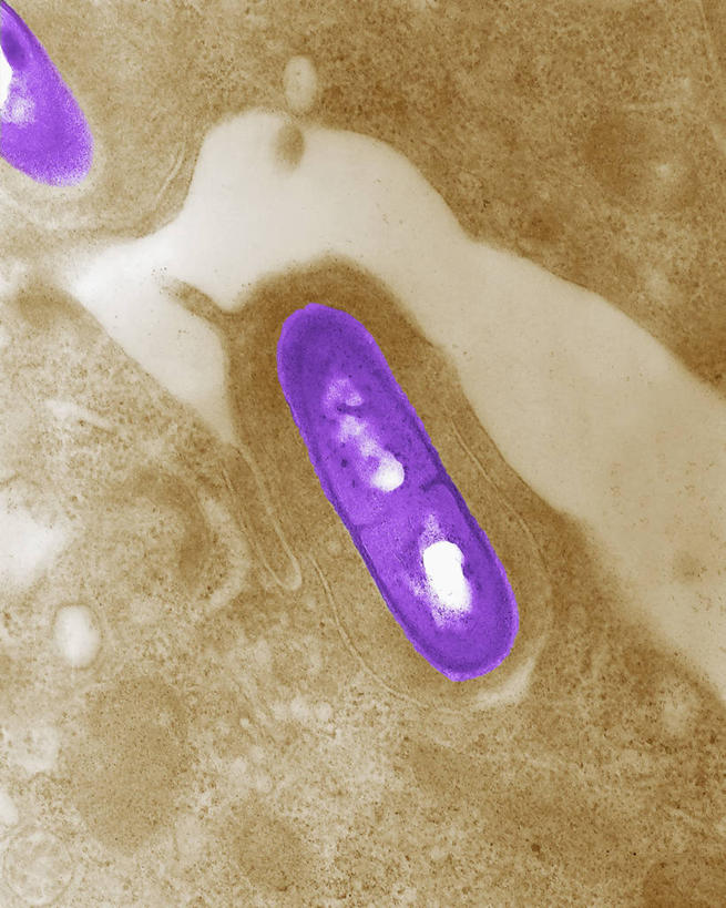 无人,竖图,科学,细菌,褐色,紫色,生病,摄影,彩图,李氏杆菌病,电子显微镜