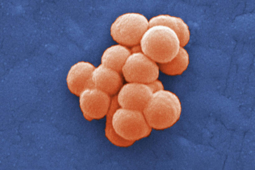 无人,横图,仪器,指示牌,检查,反射,分析,科学,细菌,圆形,标志,文字,显微镜,教育,标识,观察,生病,清晰,探索,教学,摄影,放大,观看,仔细,透镜,有毒物质,凸透镜,聚焦,关注,光学,清楚,彩图,扫描电镜,扫描电子显微镜,机构,c组