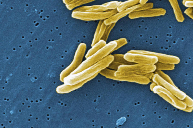 无人,横图,仪器,检查,反射,分析,科学,细菌,显微镜,观察,生病,清晰,探索,摄影,放大,观看,仔细,透镜,有毒物质,凸透镜,聚焦,关注,痛苦,光学,清楚,结核杆菌,彩图,扫描电镜,扫描电子显微镜