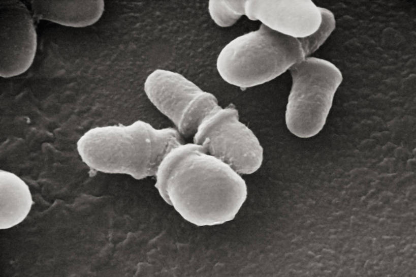无人,横图,黑白,仪器,检查,反射,分析,科学,显微镜,观察,生病,清晰,探索,摄影,放大,观看,仔细,透镜,凸透镜,聚焦,真菌,关注,光学,清楚,扫描电镜,扫描电子显微镜