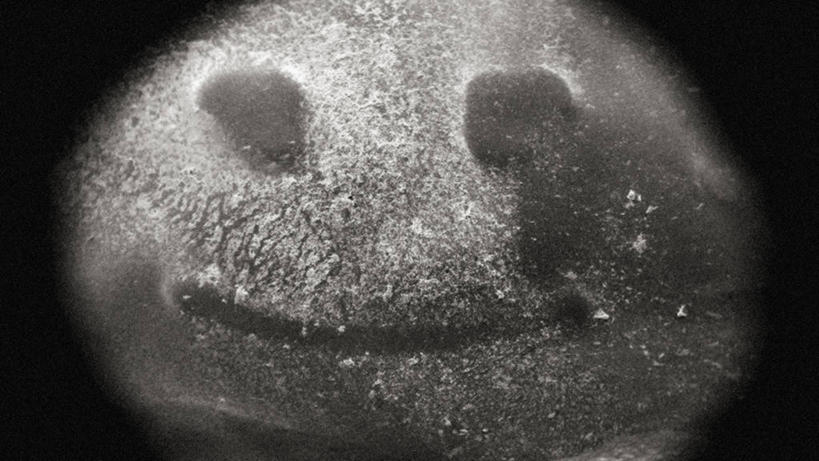 无人,微笑,横图,黑白,细菌,膜,生病,摄影,笑脸,肠胃炎,空肠弯曲杆菌