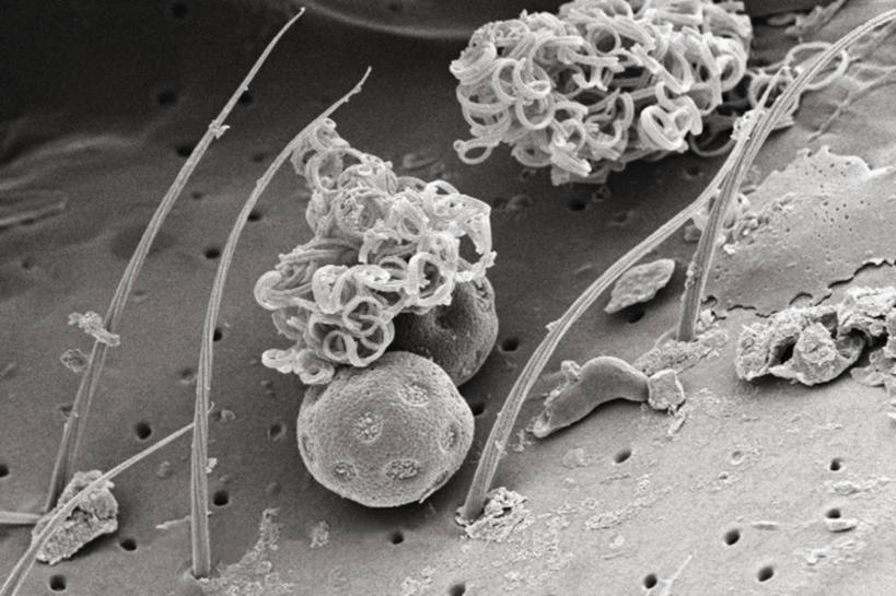 无人,横图,黑白,仪器,贝壳,检查,反射,分析,科学,昆虫,显微镜,观察,清晰,探索,摄影,放大,观看,仔细,透镜,凸透镜,聚焦,关注,节肢动物,光学,清楚,扫描电镜,扫描电子显微镜,韧性