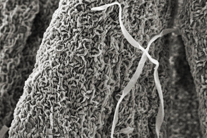 无人,横图,黑白,仪器,检查,反射,分析,科学,显微镜,花,花瓣,观察,清晰,探索,摄影,放大,观看,仔细,透镜,凸透镜,聚焦,关注,豌豆系,亚特兰大,光学,清楚,扫描电镜,扫描电子显微镜