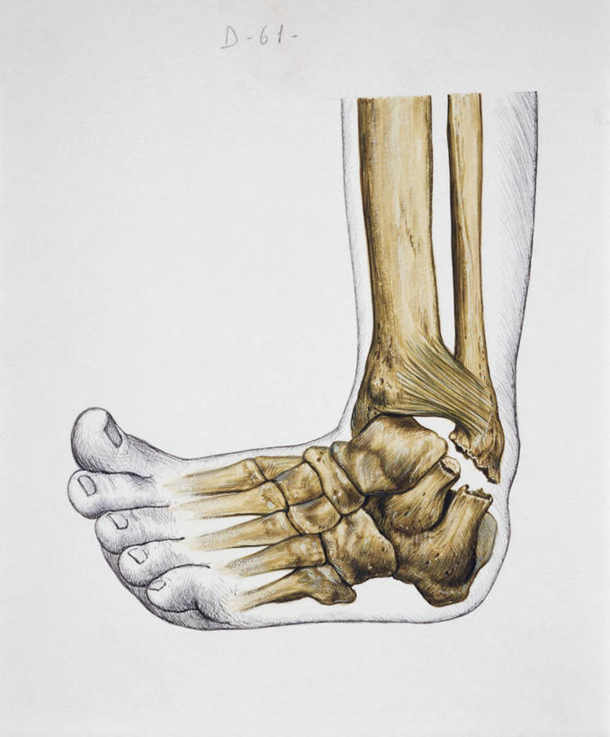 骨骼,关节,腿,无人,竖图,插画,白色背景,数码,科技,阴影,网络,高光,几何,计算机图形,合成,图画,画,人体,摄影,部分,电脑合成图,数码合成图,合成图,扭伤,漫画,足,写实,具体,具象,人体结构,彩图