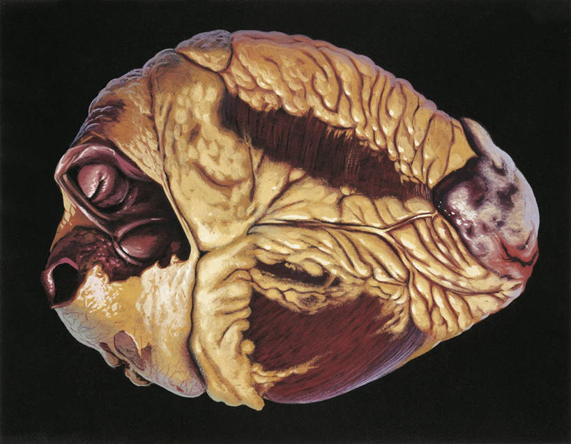 心脏,无人,横图,插画,数码,科技,阴影,黑色背景,网络,高光,几何,计算机图形,合成,图画,画,一个,人体,单个,电脑合成图,数码合成图,合成图,漫画,写实,具体,具象,人体结构,心,彩图,心肌梗塞