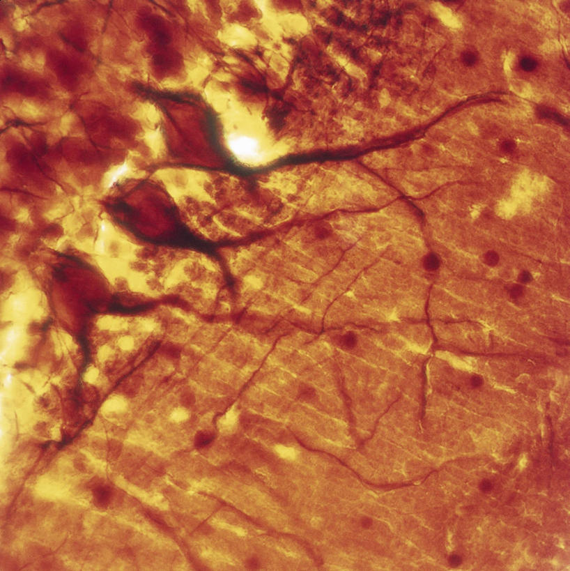 无人,竖图,方图,动物,纸巾,摄影,神经元,微生物学,彩图,全画面,全框架,全帧,全画幅