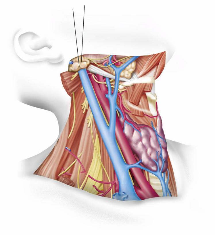 脖子,动脉,无人,竖图,插画,白色背景,数码,科技,阴影,科学,网络,高光,几何,计算机图形,合成,图画,画,白色,人体,摄影,电脑合成图,数码合成图,生物学,合成图,横截面,漫画,生理学,写实,具体,具象,淋巴结,淋巴系统,颈动脉,淋巴管,颈内静脉,人体结构,彩图,神经系统