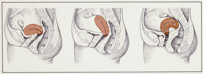 无人,横图,全景,插画,白色背景,侧面,数码,科技,阴影,网络,高光,几何,计算机图形,合成,图画,画,白色,生病,人体,多样,电脑合成图,数码合成图,疾病,生物学,合成图,横截面,漫画,写实,具体,具象,四肢,人体结构,畸形,手臂,彩图