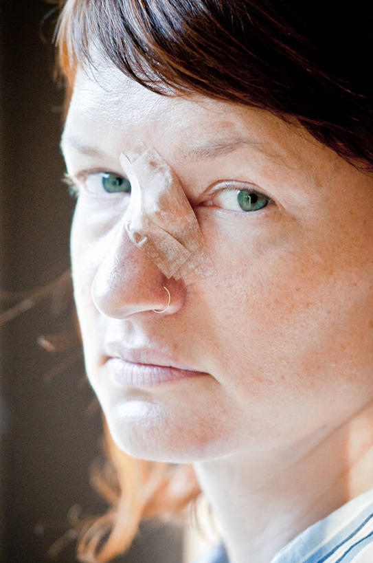 成年人,中年人,老年人,眼睛,眉毛,睫毛,一个人,竖图,特写,微生物,美国,瞳孔,仅一个女性,仅一个人,科学,医学,细胞,绿色,仅一个中年女性,人体,眼部,摄影,部分,手术,生物学,加利福尼亚,肖像,鼻钉,皮肤癌,女人,女性,中年女性,睫,眉,眼,眼睫毛,眼眉,绷带,彩图,眼眉毛,癌