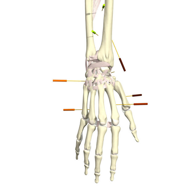 手,背,动脉,骨骼,血管,无人,方图,插画,白色背景,数码,科技,阴影,网络,骨头,高光,几何,计算机图形,合成,图画,画,生活方式,电脑合成图,数码合成图,骨架,心血管系统,合成图,脊背,针灸,漫画,恢复,写实,具体,具象,针灸针,腕骨,掌骨,趾骨,替代疗法,人体结构,彩图