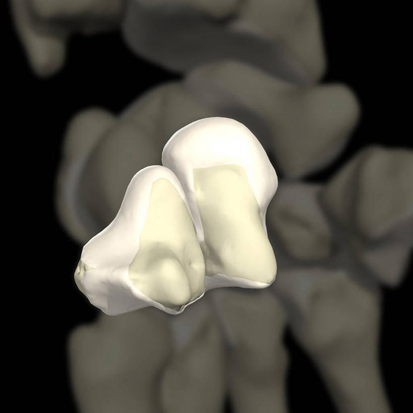 手腕,关节,无人,方图,插画,数码,科技,阴影,黑色背景,网络,高光,几何,计算机图形,合成,图画,画,电脑合成图,数码合成图,合成图,漫画,写实,具体,具象,腕骨,钩骨,人体结构,彩图,滑动关节