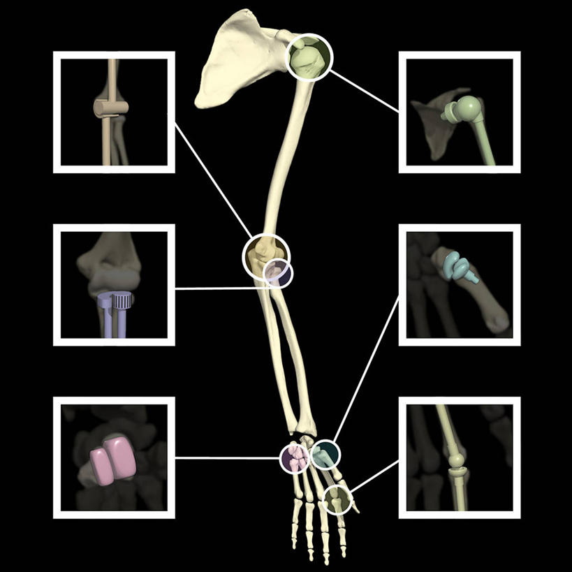 骨骼,关节,无人,方图,插画,数码,科技,阴影,黑色背景,网络,图表,骨头,高光,几何,计算机图形,合成,图画,画,滑翔,电脑合成图,数码合成图,合成图,漫画,合页,写实,具体,具象,人体结构,枢轴,手臂,彩图
