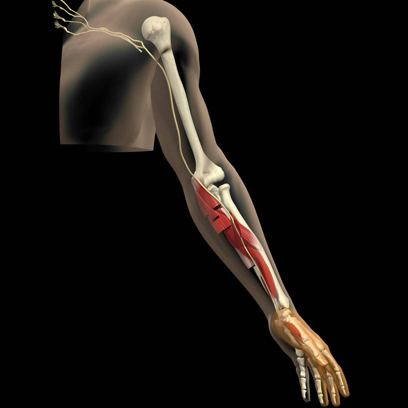 无人,方图,插画,数码,科技,阴影,黑色背景,网络,高光,几何,计算机图形,合成,图画,画,电脑合成图,数码合成图,合成图,漫画,写实,具体,具象,臂丛,脊髓神经,正中神经,人体结构,前臂,手臂,彩图