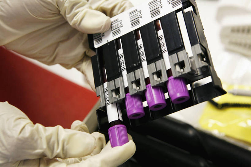 手,一个人,医院,横图,室内,特写,安全,试管,防护,拿着,英格兰,手套,摄影,保护,条形码,部分,保险,保全,周全,安稳,安定,防护手套,平安,彩图