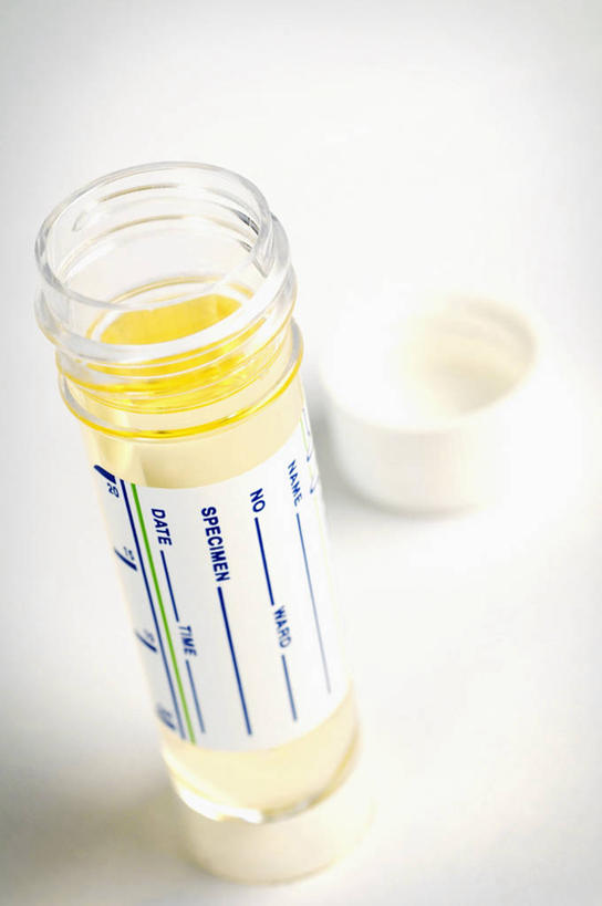 无人,竖图,俯视,白色背景,研究,标签,英格兰,两个,打开,摄影,英文字母,开启,身份,尿液,泌尿系统,彩图,高角度拍摄,影棚拍摄