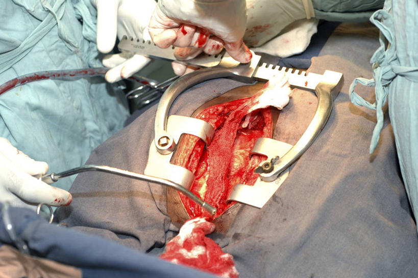 手,两个人,医院,横图,俯视,室内,安全,苏丹,科学,医学,纱布,线条,防护,手套,血液,摄影,保护,部分,手术,医疗,科学技术,保险,波动,保全,周全,安稳,安定,防护手套,手术器械,平安,彩图,高角度拍摄,脉搏波,吸气管