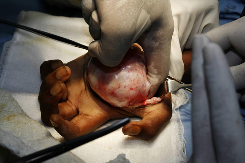 成年人,手,两个人,横图,室内,特写,安全,纱布,防护,拿着,手套,血液,摄影,保护,部分,手术,手术室,专心,肿瘤,解剖刀,保险,手术台,医疗工具,外科医生,保全,周全,安稳,安定,防护手套,平安,男人,触摸,彩图