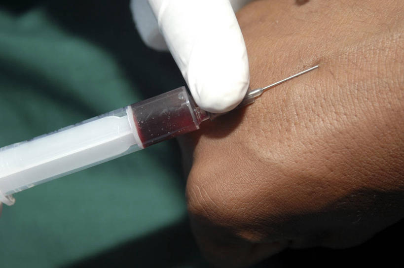 手,两个人,病人,横图,室内,特写,安全,苏丹,锐利,防护,手套,血液,摄影,保护,部分,锋利,注射器,尖锐,准确,保险,保全,周全,安稳,安定,防护手套,平安,彩图