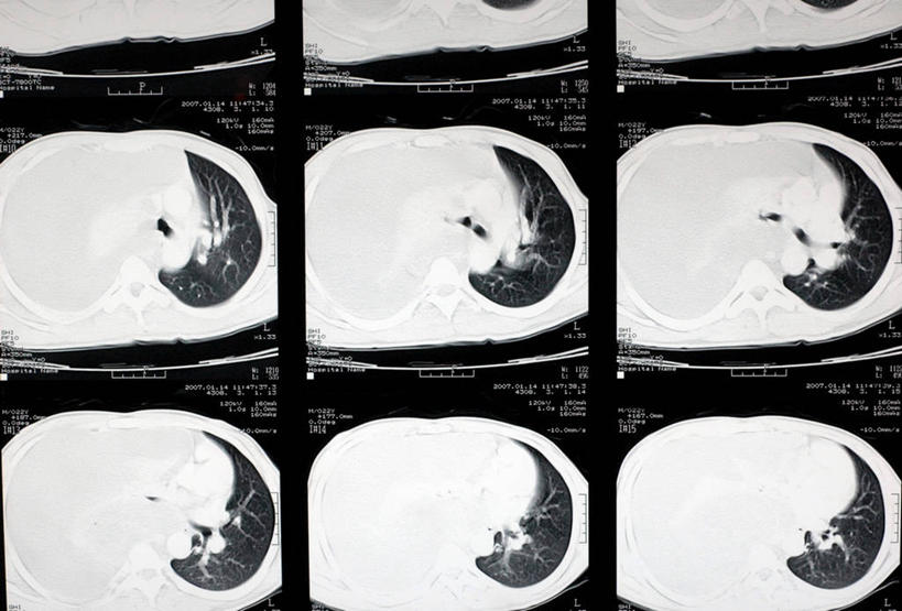 无人,医院,横图,x光片,室内,特写,白天,技术,苏丹,辐射,科学,医学,摄影,医疗,手术室,科学技术,x射线,x光,横截面,CAT扫描仪,人体结构,进展,彩图,电磁波,电磁辐射