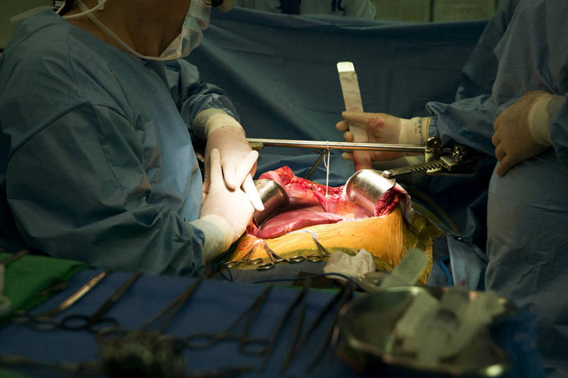 成年人,三个人,医院,站,坐,横图,室内,特写,工作服,制服,安全,合作,团队,首尔,韩国,不锈钢,分离,眼镜,防护,首都,过滤,分开,拿着,口罩,手套,职业,隔断,血液,治疗,遮掩,摄影,保护,隔离,协助,手术,医疗,卫生,手术室,准确,开刀,掩盖,遮挡,净化,间隔,保险,预防,医疗工具,遮盖,防尘,外科医生,保全,周全,安稳,安定,防护手套,掩饰,断绝,隔开,屏蔽,屏绝,远离,中断,阻遏,阻隔,消化道,吸收,工作制服,消化管,消化,排泄,手术器械,摄取,平安,男人,彩图,工作套服,外科手术,消化腺,转运,消化系统,手术衣