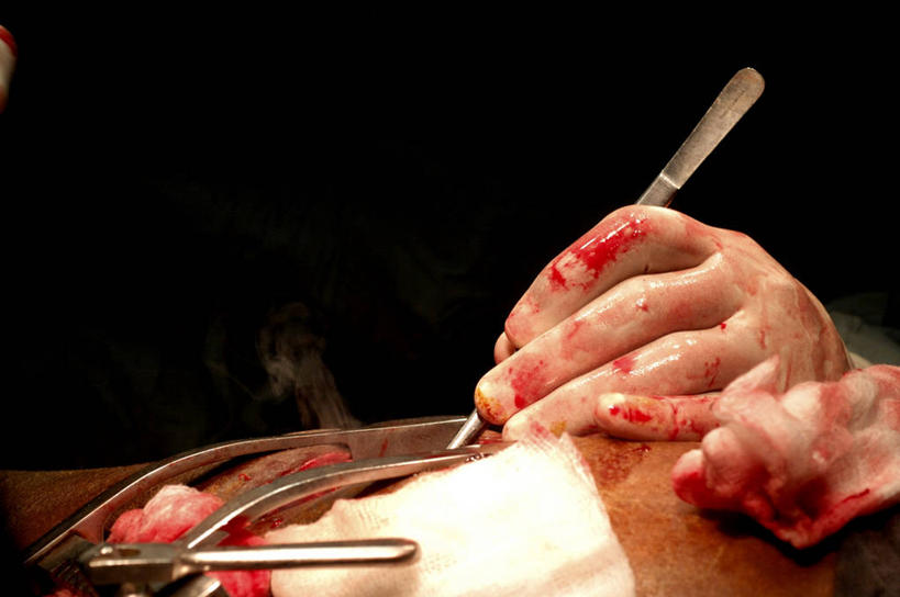 手,一个人,医院,横图,室内,特写,白天,安全,苏丹,镊子,防护,拿着,手套,躯干,血液,摄影,皮肤,保护,部分,手术,伤口,准确,解剖刀,保险,外科医生,保全,周全,安稳,安定,防护手套,技能,平安,彩图