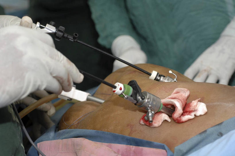 三个人,病人,横图,室内,特写,安全,合作,团队,苏丹,防护,生活,手套,日用品,血液,保健,摄影,保护,部分,卫生巾,卫生棉,准确,保险,外科医生,保全,周全,安稳,安定,防护手套,棉条,女性用品,卫生棉条,卫生栓,卫生用品,手术器械,平安,彩图,腹腔镜手术