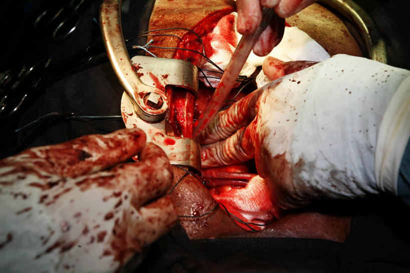 成年人,手,三个人,医生,横图,俯视,特写,安全,合作,团队,不锈钢,管子,防护,拿着,手套,职业,躯干,血液,摄影,保护,部分,手术,准确,拼接,保险,医疗工具,外科医生,保全,周全,安稳,安定,防护手套,手术器械,平安,胸部,清洗,彩图,高角度拍摄,吸气管