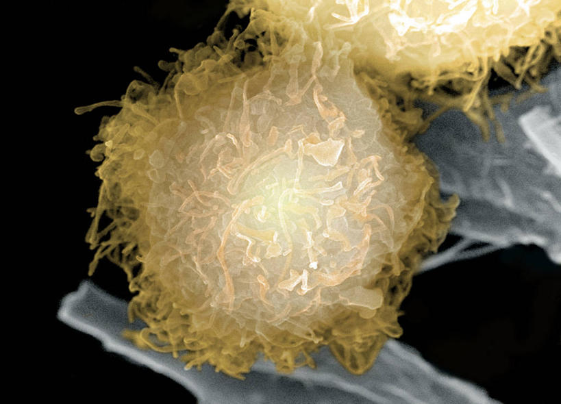 无人,横图,俯视,室内,特写,白天,仪器,微生物,黑色背景,检查,反射,分析,科学,医学,细胞,显微镜,黄色,观察,清晰,探索,放大,观看,仔细,透镜,疾病,生物学,凸透镜,聚焦,关注,肿瘤,癌症,光学,清楚,恶性肿瘤,前列腺癌,显微图片,彩图,高角度拍摄,扫描电镜,扫描电子显微镜