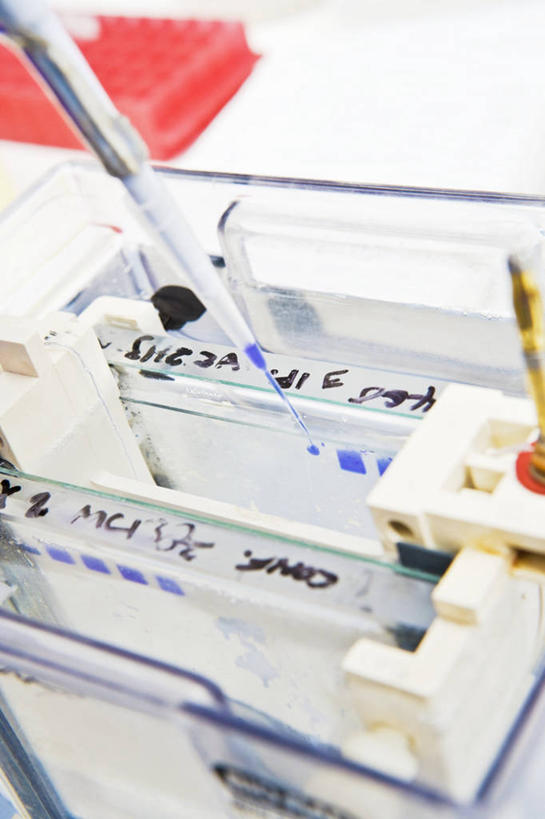 无人,竖图,俯视,室内,特写,白天,技术,实验,仪器,桌面,桌子,阴影,研究,透明,反射,分析,化学,测试,滴管,影子,实验室,研究室,玻璃制品,器皿,检测,工作台,计量,试验室,玻璃仪器,试验耗材,实验用品,吸液管,移液管,彩图,高角度拍摄,实验台,实验桌,电泳,电泳技术,凝胶电泳