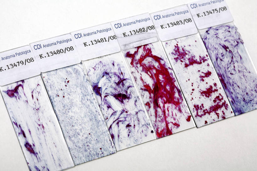 无人,横图,插画,室内,白天,白色背景,正面,数码,科技,阴影,网络,英文,标志,数字,文字,字符,字母,高光,几何,计算机图形,合成,图画,标识,画,红色,紫色,阿拉伯数字,英文字母,电脑合成图,数码合成图,合成图,漫画,载玻片,写实,具体,具象,玻片,盖玻片,彩图,宫颈刮片,宫颈抹片,刮片,抹片