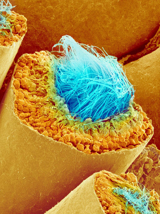 膀胱,睾丸,阴囊,尿道,无人,竖图,俯视,室内,特写,白天,仪器,检查,反射,分析,科学,显微镜,管道,蓝色,精子,观察,橙色,清晰,探索,放大,观看,仔细,透镜,凸透镜,聚焦,关注,泌尿系统,前列腺,光学,清楚,附睾,内生殖器,排泄器官,外生殖器,生殖细胞,输精管,曲细精管,精囊腺,尿道球腺,射精管,显微图片,单倍体生殖细胞,雄配子,雄性生殖细胞,雄性细胞,彩图,高角度拍摄,扫描电镜,扫描电子显微镜,男性生殖系统,生殖器官,精管,生精小管