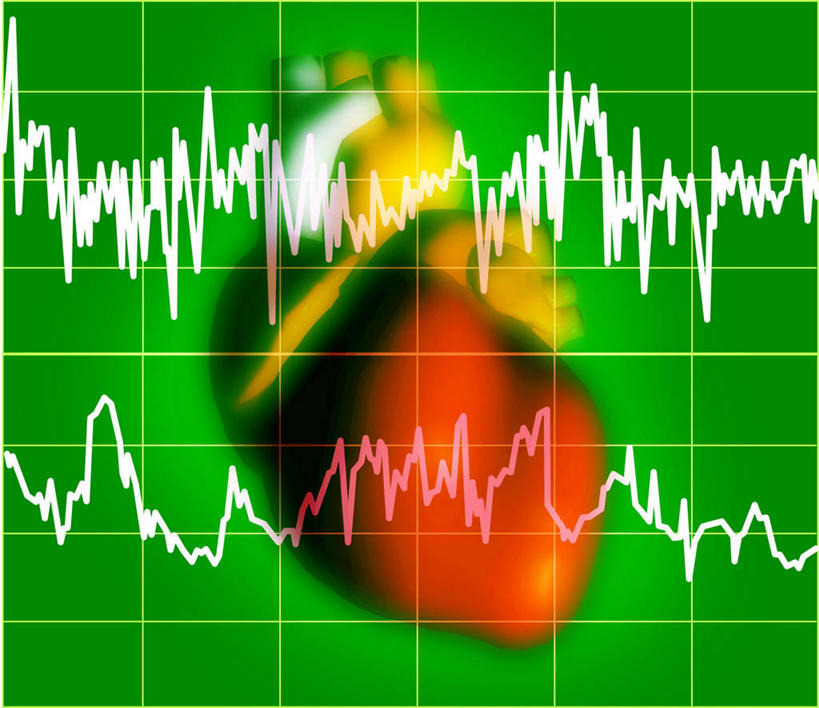 心脏,无人,横图,插画,室内,白天,正面,数码,科技,阴影,科学,网络,医学,线条,心电图,高光,几何,计算机图形,合成,图画,画,黄色,红色,电脑合成图,数码合成图,医疗,疾病,科学技术,合成图,漫画,写实,具体,具象,心血管病,心血管疾病,心脏病,循环系统疾病,心,彩图