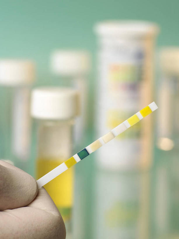 西方人,手,一个人,科学家,竖图,室内,特写,白天,正面,实验,研发,仪器,杯子,欧洲,欧洲人,仅一个男性,仅一个人,握,小便,朦胧,模糊,研究,透明,分析,科学,化学,测试,试管,纸,拿,拿着,玻璃制品,仅一个年轻男性,玻璃瓶,瓶子,手部,器皿,试纸,握着,单手,科研,尿,科研人员,化验,研究者,检验,计量,尿液,科学研究者,玻璃仪器,试验耗材,实验用品,排泄物,还元汤,轮回酒,人尿,男人,男性,年轻男性,白种人,科学工作者,玻璃杯,半身,彩图