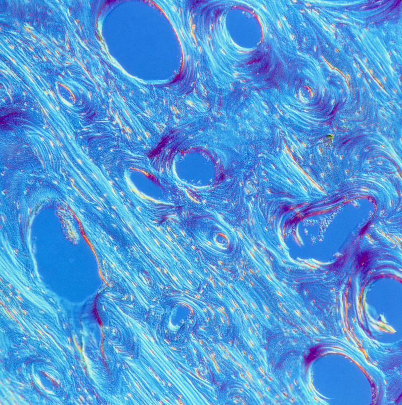 骨骼,无人,竖图,插画,室内,白天,正面,数码,科技,微生物,阴影,科学,网络,医学,细胞,骨头,高光,几何,计算机图形,合成,图画,画,蓝色,纤维,电脑合成图,数码合成图,骨架,生物学,合成图,漫画,写实,具体,具象,淋巴管,结缔组织,自然科学,博物学,生物科学,彩图,组织细胞,基本组织,基质,细胞外间质,密质骨