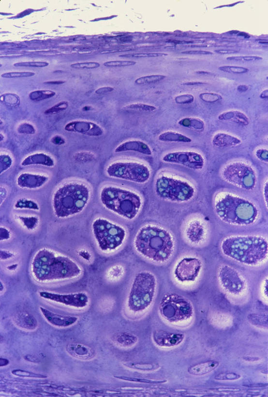 骨骼,无人,竖图,俯视,室内,特写,白天,仪器,微生物,检查,反射,分析,科学,医学,细胞,显微镜,骨头,紫色,观察,清晰,探索,放大,观看,仔细,纤维,透镜,骨架,生物学,凸透镜,聚焦,关注,软骨,光学,清楚,结缔组织,显微图片,自然科学,博物学,生物科学,彩图,高角度拍摄,组织细胞,扫描电镜,扫描电子显微镜,基本组织,基质,细胞外间质